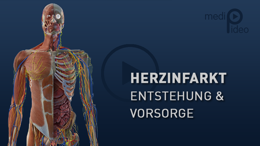 Herzinfarkt - Entstehung und Vorsorge